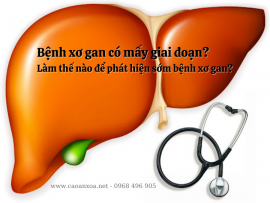 Bệnh xơ gan có mấy giai đoạn? Làm thế nào để phát hiện sớm bệnh xơ gan?