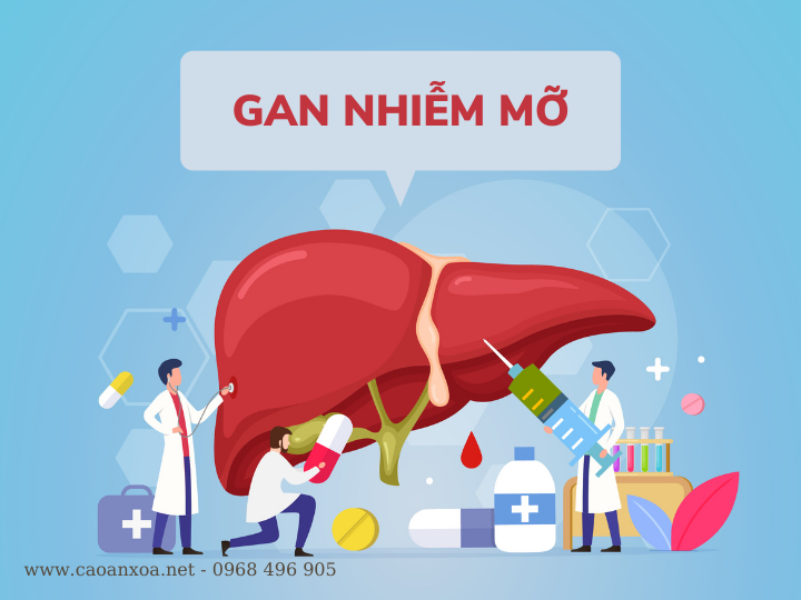 Gan nhiễm mỡ gây biến chứng xơ gan