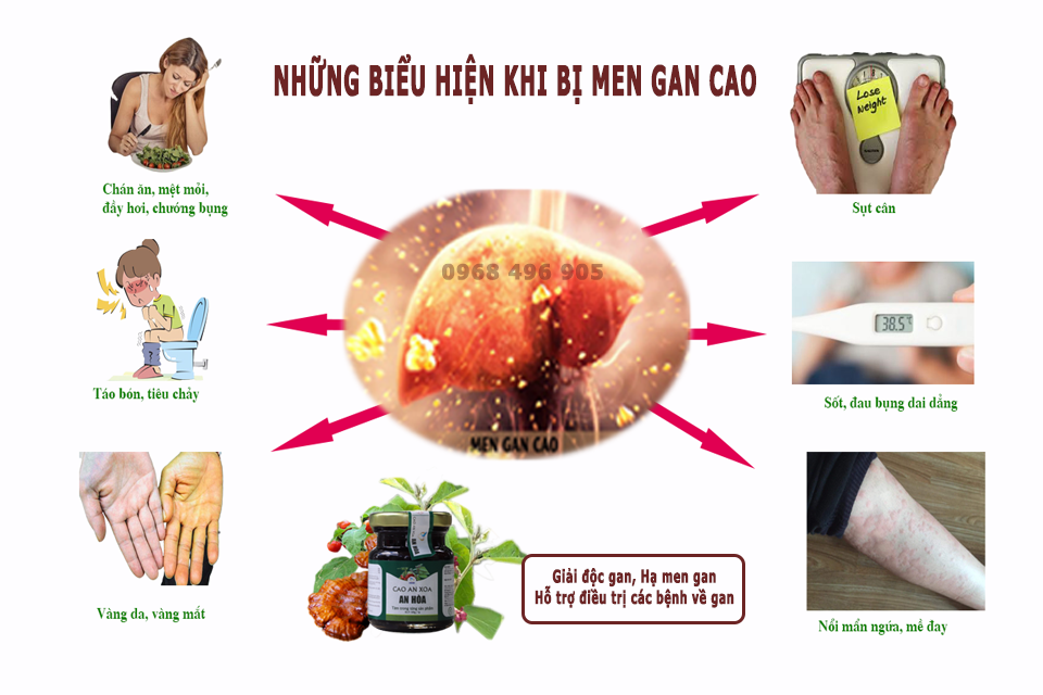 Những triệu chứng thường gặp của người bị men gan cao